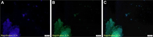 Figure 9 Immunohistochemical staining of breast tumor from mice.Notes: Complex of plasmid with (T:S)1,040 μM cationic vesicles were injected in to the tumor. (A) Nuclei. (B) Cells expressing GFP. (C) Merged.Abbreviations: S, squalene; T, Tween 80.