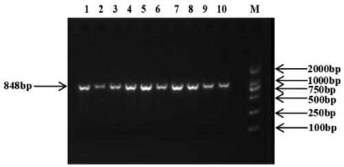 Figure 2. PCR amplification of the target fragments of the ovine IGFALS genes. Note: M: DL2000 DNA Marker; 1–10: PCR products