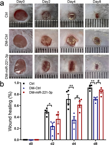 Figure 1 Effects of miR-221-3p on wound healing in diabetic mice. Representative photomicrographs (a) and summary data (b) showing changes in the area of excisional wounds on days 0, 2, 4 and 8 in diabetes mice injected with either miRNA mimic negative control (Ctrl) or miR-221-3p agomir (miR-221-3p) (n = 4). Data are presented as mean ± SEM, n = 4. *P < 0.05, **P < 0.01 for Ctrl vs DM-Ctrl. #P < 0.01 for DM-Ctrl vs DM-miR-221-3p.