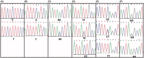 Figure 2. Sequencing results of the six single nucleotide polymorphisms (SNPs). (A) Sequencing results of the TEX11 rs6525433; (B) Sequencing results of the TEX11 rs4844247; (C) Sequencing results of the TEX15 rs323344; (D) Sequencing results of the TEX15 rs323346; (E) Sequencing results of the MLH1 rs1800734; (F) Sequencing results of the MLH3 rs175080. TEX11: testis expressed gene 11; TEX15: testis expressed gene 15; MLH1: mutL homolog 1; MLH3: mutL homolog 3.