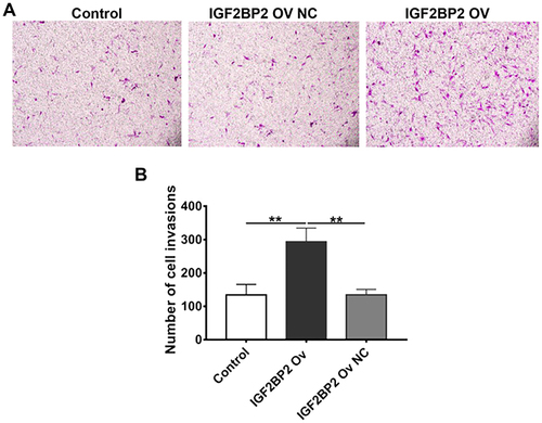 Figure 6 Cell invasion analysis after IGF2BP2 overexpression. A Transwell assay was used to detect cell invasion ability. (A) Representative images of the control group, the IGF2BP2 overexpression group, and the IGF2BP2 overexpression negative control group. (B) The number of invaded cells. Compared with the control group and the IGF2BP2 Ov NC group, the IGF2BP2 Ov group had significantly more cells passing through the basement membrane of the chamber, P < 0.01. This indicates that overexpression of IGF2BP2 can enhance the invasion ability of MDA-MB-231 cells. (**P < 0.01).