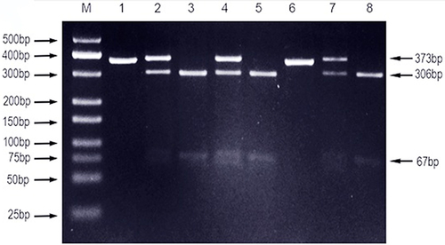 Figure 1 PCR-RFLP assay for analyzing the TLR4-rs4986790 A/G polymorphisms in Sudanese pulmonary Tuberculosis patients.