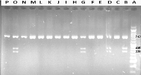 Figure 1. Representative PCR-RLFP results for the MT1A (A>G) polymorphism. Lane A, DNA ladder (Vivantis, Malaysia). Lanes B, D, G and O, A/G (heterozygous) genotype; Lanes C, E, F, H, I, J, K, L, M, N and P, A/A (major homozygous) genotype. Note: Agarose gel (2%). PstІ restriction enzyme was used for digestion of the PCR product (743 bp).