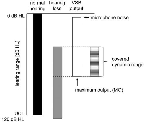 Figure 1. Schematic overview of the hearing range of subjects with hearing loss compared to subjects with normal hearing and the maximum output (MO). The covered dynamic range reflects the part of the dynamic range accessible to the patient by using an implant. The dynamic range is determined as the difference between MO of the implant system and the hearing threshold of the patient.