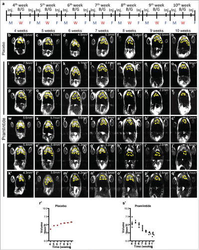 Figure 5. Administration of pramlintide prior to thymic lymphoma formation in p53-deficient mice. Schedule of MRI imaging and injection (Inj.) of Pramlintide acetate in mice with p53 deficient thymus. MRI imaging at 10, 11, 12, and 13 weeks after treatment with placebo (b-h) or Pramlintide acetate (i-q'). Tumor volume is indicated (mm3) within each panel. The tumors are indicated by the dashed yellow line. Days of the week are shown as Monday (M), Wednesday (W), Friday (F). Blood glucose (B/G) levels were assessed every Wednesday at the time of MRI.
