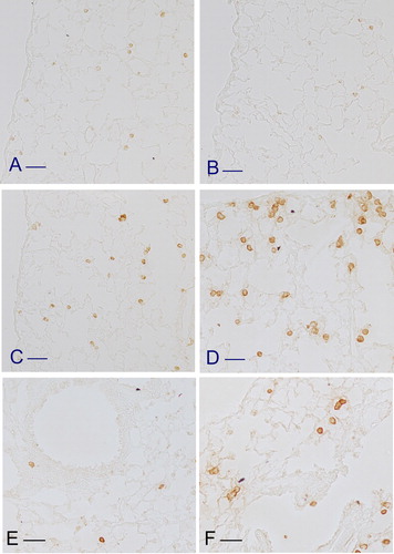 Figure 6. Immunohistochemical staining for chitinase-3like protein (ECF-L) in lungs of mice exposed to cigarette smoke for 5 months. A remarkable number of ECF-L positive macrophages are seen in lung parenchyma of mice that develop consistent fibrotic lesions such as DBA/2 (C and D) and p66 deficient mice (F). A trivial number of macrophages showing positivity for ECF-L is found in lung tissue of ICR (A), C57 Bl/6 (B) and Lck knockout mice (E). Scale bars = 100 µm.