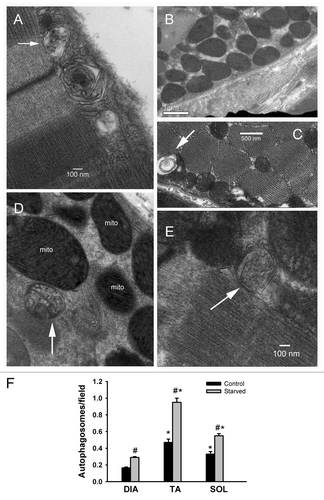 Figure 4. Detection of autophagosomes using electron microscopy. (A, D, and E) Representative electron micrographs of autophagosomes (white arrows) in DIA, TA, and SOL muscles, respectively, of acutely starved mice. Mito refers to the nucleus and mitochondria, respectively. (B) Representative electron micrographs of normal sub-sarcolemmal and intermyofibrillar mitochondria in DIA of control mouse. (C) Representative electron micrograph of an autophagosome in TA of a control mouse. (F) Autophagosome numbers in DIA, TA, and SOL muscles of control and acutely starved mice. Values (means ± SEM) are expressed as the number of autophagosomes per field. n = 4 per group. *P < 0.05, as compared with DIA. #P < 0.05 compared with control.