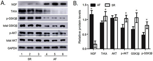 Figure 3. The protein expressions of NGF, TrKA, GSK3β, p-S9 GSK3β, AKT and p-S473 AKT were detected in the myocardial tissue of right atrium. (A) The protein expressions of NGF, TrKA, GSK3β, p-S9 GSK3β, AKT and p-S473 AKT in the myocardial tissue of right atrium by Western blot. (B) Quantitative assessment of the protein expressions of NGF, TrKA, GSK3β, p-S9 GSK3β, AKT and p-S473 AKT in the myocardial tissue of right atrium in AF patients compared to that in SR patients. *p< .05 vs. AF. AF, atrial fibrillation; SR, sinus rhythm; Akt, protein kinase B; GSK3β, Glycogen synthase kinase 3β; NGF: nerve growth factor.