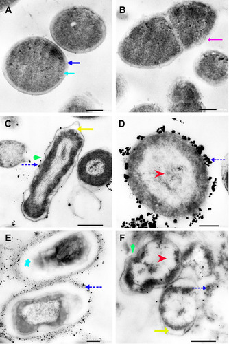 Figure 5 TEM micrographs of untreated E. coli showing bacterial cell membranes comprising multiple layers that include a cytoplasmic membrane (blue arrow), a peptidoglycan layer in periplasmic space (dark blue arrow), and outer membrane (pink arrow) (A and B). TEM micrographs of E. coli treated with AgNO3 showing folded membranes (green arrow), precipitation of dark spherical granules believed to be Ag-NPs synthesized by E. coli (blue dashed arrow), detachment of cellular membranes around the cytoplasmic matrix (yellow arrow), and moderate cytoplasm dissolution (red arrow) (C and D). TEM micrographs of E. coli exposed to N-SNPs showing shrinkage, cellular membranes with dark dense spherical particles thought to be N-SNPs (blue dashed arrow), severe cytoplasm dissolution (red arrow), detachment of cellular membranes around the cytoplasmic matrix (yellow arrow), folded membranes (green arrow) and nucleoagglutination (blue star) (E and F). Scale bars: 200 nm and 500 nm.