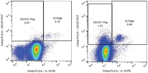 Figure 1 ILCregs from normal donors and AML patients.Notes: The different expression patterns of ILCregs from normal donors (right panel) and AML patients (left panel) are shown in Figure 1. Single-cell populations with SSC vs FSC were selected and were further gated on the CD45+Lin- population. Furthermore, gating of CD127+IL-10+ and CD127+IL-10- sub-population was done by different fluorescence-conjugated antibodies' combinations. Regulatory innate lymphoid cells were identified as CD45+Lin-CD127+IL-10+ population. At least a total of 1 million cells were collected for analysis of ILCreg cells.