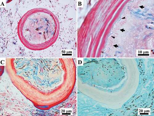 Figure 9. Sarcotragus spinosulus. LM photo-micrographs of skeletal histological sections. (A-B). Fibres showing the inner apposition of ordered laminae in the bark (pink) (arrows) and amorphous collagen material (light blue) (arrowheads) interposed between the layers. (C). Fibre with a pink laminated bark with the red, most external, layer and a core containing filaments (blue) embedded in an amorphous material (pale yellowish) (A-C cross-section, Masson trichrome). (D). Fibre with a colourless laminated bark and a core containing colourless filaments embedded in a turquoise amorphous glycosaminoglycan(GAG)-like material. Note the abundant GAG-like material also in the extracellular matrix (ECM) (cross-section, Alcian blue) (C-D successive sections of the same fibre)