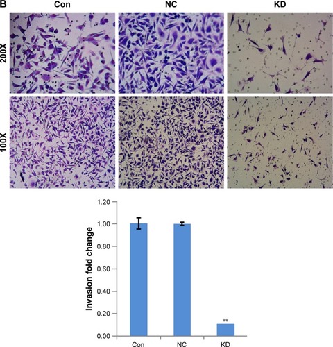 Figure 4 Knock-down RP11–357H14.17 suppresses migration and invasion of DGC cells. Cell migration and invasion were determined by wound healing assay and transwell assay.