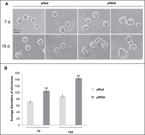 Figure 5. Dbl oncoprotein affects acinar structures. (A) Phase-contrast images illustrate the development of acinar structures in pRed and pRDbl cells at 7 (7 d) and 15 (15 d) days. Scale bar: 100 μm. (B) The mean (± SD) diameters of pRed and pRDbl acini after the indicated days in basement membrane culture are shown. **P < 0.01.