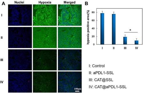 Figure 6 Effects of control (PBS), aPDL1-SSLs, CAT@SSLs, and CAT@aPDL1-SSLs on tumor hypoxia status.Notes: (A) Immunofluorescence images of tumor slices harvested from B16-F10 tumor-bearing mice following intravenous injection with four different formulations. The blue signals represent nuclei stained by DAPI and the green signals represent hypoxia areas stained by hypoxia probe, respectively. (B) The quantitative results of positive tumor hypoxia areas analyzed using Image J software based on the images shown in (A). (n = 3, results are means ± S.D., Scale bar: 100 μm,*P < 0.05)Abbreviations: aPDL1, programmed death ligand 1 monoclonal antibody; CAT, catalase; SSL, sterically stabilized liposome; aPDL1-SSLs, aPDL1 modified immunoliposomes; CAT@aPDL1-SSLs, CAT-loaded immunoliposomes.