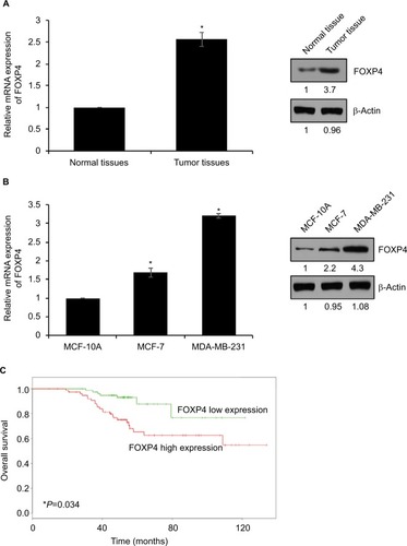 Figure 1 FOXP4 is highly expressed in BC tissues and cell lines.Notes: (A) FOXP4 expression in BC tissues was detected by qRT-PCR and Western blot. *P<0.05. (B) FOXP4 expression in BC cell lines, including MCF-7 and MDA-MB-231, was detected by qRT-PCR and Western blot. *P<0.05. (C) Kaplan–Meier analysis was used to identify the effect of FOXP4 expression on the prognosis of BC patients. *P<0.05.Abbreviations: BC, breast cancer; qRT-PCR, real-time polymerase chain reaction.
