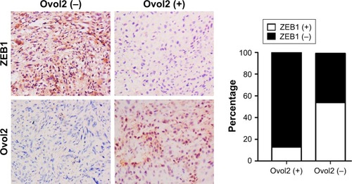 Figure 5 Expression of Ovol2 is concomitant with decreased ZEB1 expression in human OS tissues.