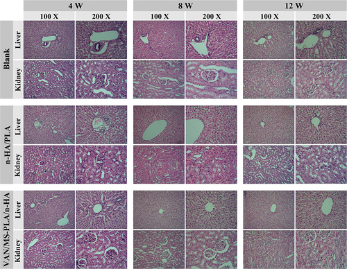 Figure 8 In vivo toxicity of experimental animals in different scaffold groups evaluated at 4, 8, and 12 weeks (liver and kidney tissue).