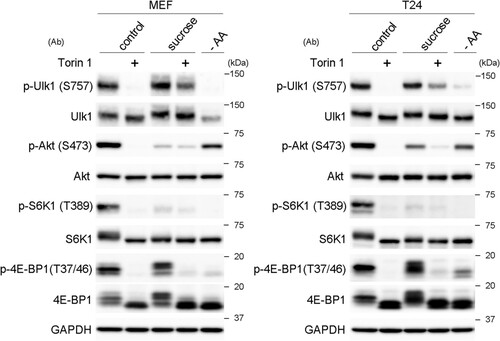 FIG 6 mTORC1 contributes to the phosphorylation of Ulk1 at S757 under hyperosmotic stress. Wild-type MEFs and T24 cells cultured for 1 h in DMEM with DMSO (control) or 1 μM torin 1 (+) were further cultured for 1 h in DMEM with 0.8 M sucrose containing the same reagents. The cells were also cultured in amino acid-free DMEM (−AA) for 1 h. The cell lysates were analyzed for Western blotting using antibodies against phosphorylated Ulk1 (S575), Ulk1, phosphorylated Akt (S473), Akt, phosphorylated S6K1 (T389), S6K1, phosphorylated 4E-BP1 (T37/46), 4E-BP1, and GAPDH as a loading control. Molecular weights are indicated on the right.