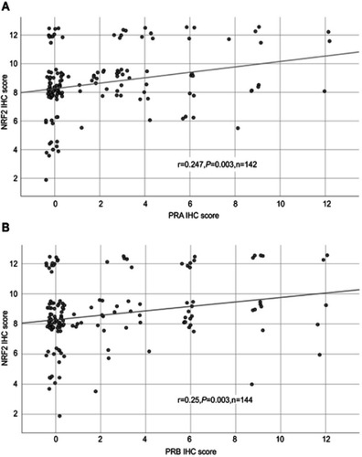 Figure 3 Correlation analysis of NRF2 and PRA/PRB.Notes: Correlation analysis of NRF2 and PRA (A)/PRB (B) in ovarian cancer tissue. A significant correlation of cytoplasmic NRF2 expression with PRA/PRB expression was noted. For better visualization, dots have been jittered.Abbreviations: r = correlation coefficient, p = two-tailed significance, n = number of patients.