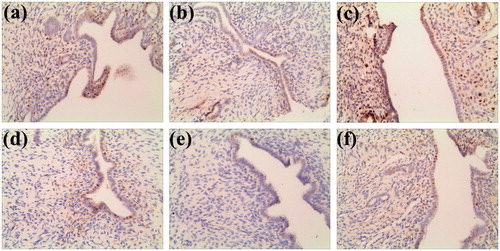 Figure 3. Representative ER expression of uterus in the endometrium. (a) SHAM group, (b) OVX group, (c) E2 group, (d) DZW-L group, (e) DZW-M group and (f) DZW-H group. The OVX rats presented notable reduction of ER labelling compared with the SHAM rats. DZW and E2 partially prevented OVX-induced ER expression reduction.