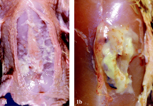 Figure 1. 1a: Subcutaneous, diffuse accumulation of fibrinous exudate in and around the keel bursa of a broiler chicken carcass infected with M. synoviae. 1b: Extensive localized accumulation of caseous exudate in the keel bursa of a 47-day-old broiler chicken infected with M. synoviae.