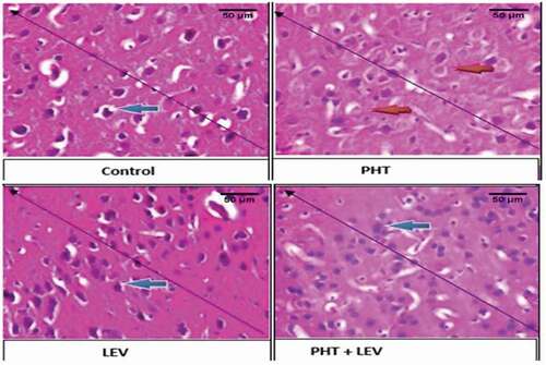 Figure 6. The histomorphology of pre-frontal cortex following PHT, LEV and PHT+ LEV adjunctive treatment in male Wistar rats