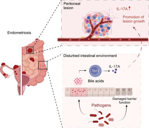 Figure 8 Schematic illustrating the proposed pathogenic mechanism of disrupted gut microbiota in endometriosis Created with biorender.com.