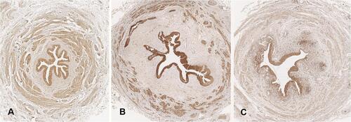 Figure 1 Histological appearance with Gli1 staining (Original magnification ×3). (A) Un-stented control ureter. (B) Ureter with 0.3 F suture thread. (C) Ureter with the double-pigtail stent.