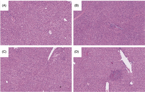 Figure 2. Stained liver sections. Samples shown are representative H&E-stained sections. (A) Control. (B) AQ. (C) CCR2−/−. (D) CCR2−/−/AQ. Group identities are defined in Figure 1 legend. Liver histology appeared similar between groups, with only a few necro-inflammatory foci being noted in the tissues from the AQ-treated groups.