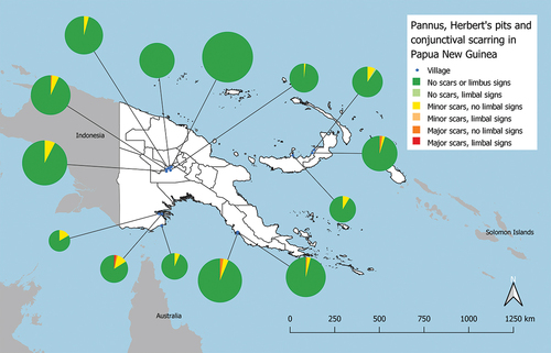 Figure 2. Geographical distribution of clinical signs of trachoma in 14 selected villages of Papua New Guinea, 2020. ‘Minor scars’ refers to an individual with conjunctival scarring graded C1 in at least one eye. ‘Major scars’ refers to an individual with conjunctival scarring graded C2 or C3 in at least one eye. ‘Limbal signs’ refers to an individual with pannus ≥2 mm and/or ≥1 Herbert’s pit in at least one eye. The severity is based on the most severely affected eye in an individual. The boundaries and names shown and the designations used on this map do not imply the expression of any opinion whatsoever on the part of the authors, or the institutions with which they are affiliated, concerning the legal status of any country, territory, city or area or of its authorities, or concerning the delimitation of its frontiers or boundaries.