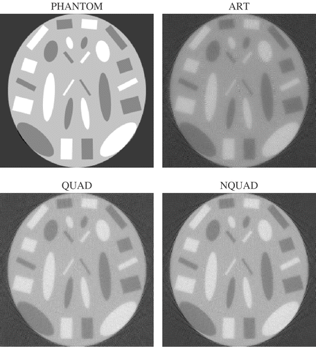 Figure 8. Case 4: phantom and reconstructed images after 10 iterations.
