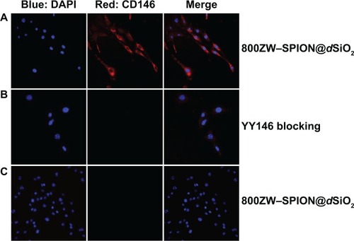 Figure 5 Confocal microscopic image of 800ZW–SPION@dSiO2–YY146.Notes: In vitro investigation of nanoparticle binding affinities of CD146 on MKN45 cells: cells were incubated with (A) 70 μL of 5 nmol/mL 800ZW–SPION@dSiO2–YY146, targeting group (B) YY146 (200 μg ×3) blocking and 70 μL of 5 nmol/mL 800ZW–SPION@dSiO2–YY146, (C) 70 μL of 5 nmol/mL 800ZW–SPION@dSiO2. Strong staining of cell membrane was observed in targeting group (A) whereas background levels were seen in blocking (B) and control (C) (40× oil).Abbreviations: SPION, superparamagnetic iron oxide nanoparticles; DAPI, 4′,6-diamidino-2-phenylindole.