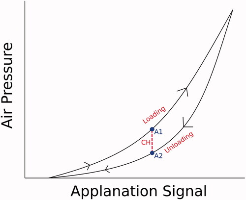 Figure 6. Schematic illustrating corneal hysteresis (CH). Specifically, this term is defined as the difference between inward and outward applanation pressures using the Ocular Response Analyzer (ORA). Pressures at applanation points, A1 and A2, are captured by the ORA during the loading and unloading pathways and used to calculate CH.