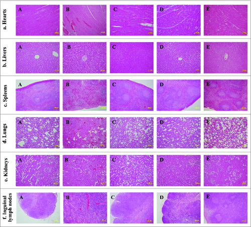 Figure 4. Histopathologic observation of the tissues from the animals infected with the Y. pestis Microtus 201 and the vaccine EV. Tissue sections were stained with hematoxylin and eosin for pathological examination after infection with Y. pestis. (A) Tissue sections from the animals infected intravenously with 9 × 108 CFU of the Y. pestis Microtus 201. (B) Tissue sections from the animals infected intravenously with 1.28 × 1010 CFU of the Y. pestis Microtus 201. (C) Tissue sections from the animals infected intravenously with 9.6 × 108 CFU of the vaccine EV. (D) Tissue sections from the animals infected intravenously with 1.5 × 1010 CFU of the vaccine EV. (E) Tissue sections from one normal animal.