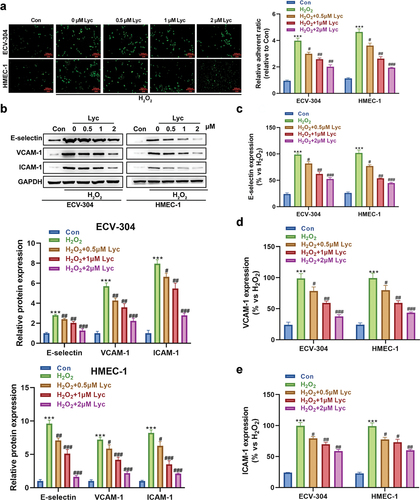 Figure 2. Lycopene reduces H2O2-induced monocyte endothelial adhesion and adhesion molecule levels in endothelial cells.