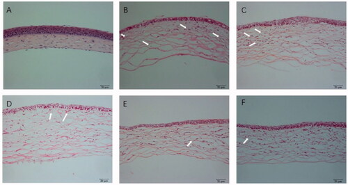 Figure 12. HE staining of cornea: (A) hematoxylin and eosin (HE) staining of corneal sections in the normal group (×200); (B) HE staining of corneal sections in the saline group (×200); (C) HE staining of corneal sections in the 0.25% NAR-ME group (L group) (×200); (D) HE staining of corneal sections in the 0.5% NAR-ME group (M group) (×200); (E) HE staining of corneal sections in the 1% NAR-ME group (H group) (×200); (F) HE staining of corneal sections in the glucocorticoid group (DXMS group) (×200). The white arrow indicates corneal neovascularization.