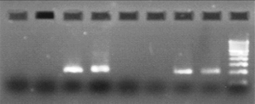 FIGURE 7  PCR positive for IS6110 of Mycobacterium tuberculosis.