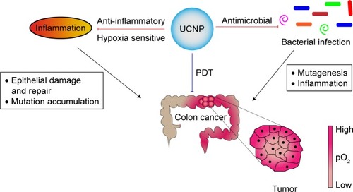 Figure 1 In vivo applications of UCNPs in intestinal infection, inflammation, and colorectal cancer.Notes: In this figure, we depict potential (red arrows) and current (blue arrow) target areas where UCNPs can be used either for imaging or treating infection, inflammation, and colon cancer. Bacterial infection and/or inflammation leading to IBD and colorectal cancer are depicted with black arrows. UCNPs loaded with antimicrobial and anti-inflammatory compounds can be used to treat infection, inflammation, and cancer. Furthermore, hypoxia-sensitive UCNPs can be used to monitor the hypoxic state of the gastrointestinal tract. Due to the NIR excitation range, UCNPs are currently being used for localized PDT in certain cancer forms.Abbreviations: IBD, inflammatory bowel disease; NIR, near infrared; PDT, photodynamic therapy; UCNPs, upconverting nanoparticles.