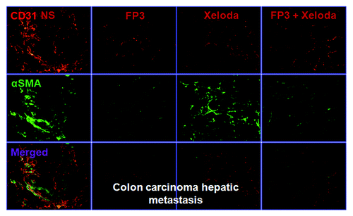 Figure 5. FP3 and capecitabine (Xeloda) decreased vascular structure in the xenograft model of colon carcinoma hepatic metastasis. Vasculature was examined by angiography with immunostaining for endothelial cells (using anti-CD31 antibody; bar = 100 μm), and pericytes (using anti-α-SMA antibody; bar = 100 μm).