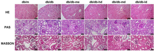 Figure 6 Pathological changes of DN in db/db mice treated with BSR for 24 weeks. Animals were assigned into six group (n = 25): control group (db/m), model group (db/db-m), positive group (db/db-me) and BSR at high- (db/db-hd), medium- (db/db-md) and low (db/db-ld) doses group. The data are shown as the mean±SD.