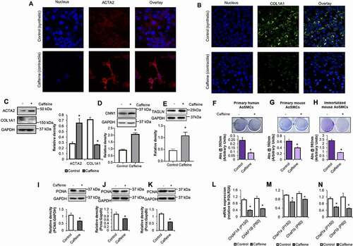 Figure 2. Caffeine stimulates phenotypic switching and inhibits the proliferation of primary and immortalized aortic smooth muscle cells Immunofluorescence analysis of AoSMCs phenotypic markers (A) ACTA2 and (B) COL1A1 respectively. Images were captured at 40x magnification and representative pictures were shown. Western blot analysis of AoSMCs phenotypic markers. (C) ACTA2 and COL1A1 and (D) CNN1 in immortalized mouse AoSMCs treated with or without caffeine (2 mM) for 48 h. (E) TAGLN in immortalized mouse AoSMCs treated with or without caffeine (2 mM) for 48 h. Quantitative analysis of AoSMCs phenotypic markers ACTA2, COL1A1, CNN1, and TAGLN was done and plotted as bar graphs. Crystal violet staining was performed on (F) primary human AoSMCs, (G) primary mouse AoSMCs, and (H) immortalized mouse AoSMCs, and absorbance was quantified as arbitrary units. Shown are representative images of wells containing cells treated ± caffeine (2 mM) for 48 h. Western blot analysis to determine PCNA was performed on (I) primary human AoSMCs, (J) primary mouse AoSMCs, and (K) immortalized mouse AoSMCs, treated ± caffeine (2 mM) for 48 h. RT-qPCR analyses of proliferation marker CHAF1A (splice variants p150) and CHAF1B (splice variants p60) in (L) primary human AoSMCs, (M) primary mouse AoSMCs, and (N) immortalized mouse AoSMCs treated ± caffeine (2 mM) for 48 h. Results are expressed as mean ± SD. The statistical significance of differences (*P < 0.05) was assessed by a one-way or two-way ANOVA wherever applicable, followed by Tukey’s multiple-comparisons test, N = 3.