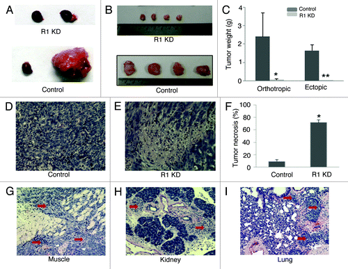 Figure 3. VEGFR-1 knockdown significantly inhibits tumor growth and invasion. (A and B) Representative pictures of orthotropic (A) and ectopic (B) control and VEGFR-1 knockdown tumors. Normal right kidney and tumor-bearing left kidney are shown in orthotropic tumors. (C). The weight of VEGFR-1 knockdown tumors is significantly decreased in both orthotropic and ectopic tumors compared with their control. In orthotropic tumors, the weight difference between the tumor-bearing left kidney and the normal right kidney was used as tumor weight. *p < 0.05 vs. orthotropic control. **p < 0.01 vs. ectopic control. (D and E) Representative picture of H&E stain control (D) and VEGFR-1 knockdown (E) tumor sections. (F) The percentage of tumor necrosis was significantly increased in VEGFR-1 knockdown tumors compared with control tumors. *p < 0.01 vs. control. (G-I) Representative pictures of control tumor cells invade adjacent muscle tissue (G, red arrows) in the ectopic model, invade the kidney (H, red arrows) in the orthotropic model, and metastasize to the lung in both models (I, red arrows).