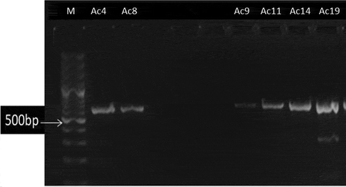 Figure 2. PCR amplicons of A. baumannii strains CTX-M-15 gene. Lanes order is as follows: marker (100 bp); isolates number