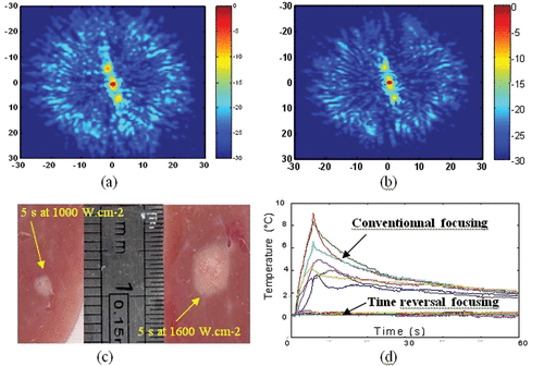 Figure 4. Spatial directivity pattern of the transcostal ultrasonic beam in the focal plane using (a) conventional focusing and (b) time reversal focusing. (c) Necrosis obtained using time reversal focusing through the rib cage in liver samples for a 5-s duration at 1000 W · cm−2 and for a 5-s duration at 1600 W · cm−2. (d) Temperature elevation at several locations on the rib cage with conventional and time reversal focusing. The temperature elevation is estimated using implanted thermocouples (Iron-constantan, 40 µm diameter, PhysiTemp Corp.).