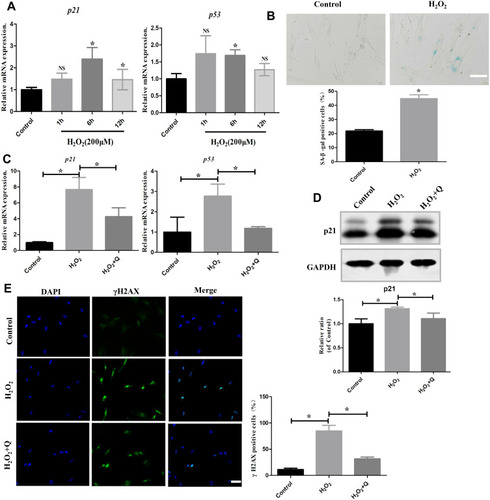 Figure 3 Quercetin alleviates cellular senescence in vitro. (A) mRNA expression levels of senescence markers (p21 and p53) in hPDLCs treated with 200 μM H2O2 for 1 h, 6 h and 12 h. (B) Representative SA-β-gal staining images and quantification of cells in the different treatment groups. Scale bar: 50 μm. (C) mRNA expression levels of senescence markers (p21 and p53) in hPDLCs after quercetin treatment. (D) Representative Western blotting images of p21 protein and quantification in hPDLCs. (E) Representative images and quantification of γH2AX-positive cells stained with DAPI after different treatments (green: γH2AX; blue: DAPI). Scale bar: 50 μm. All data are presented as the mean ± SD, *p < 0.05.