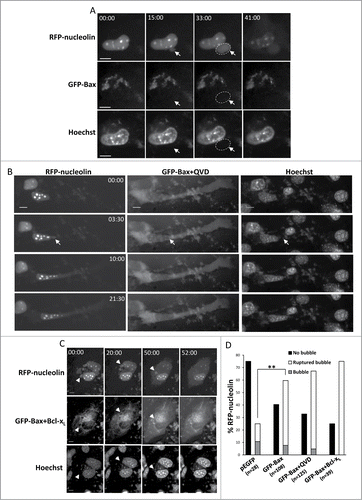 Figure 4. For figure legend see page 533.Figure 4 (See previous page). Restoration of Bax expression in Bax/Bak DKO MEFs promotes SIGRUNB in a caspase- and Bcl-xL-independent manner. Bax/Bak DKO MEFs were co-transfected with RFP-nucleolin and pEGFP or with RFP-nucleolin and GFP-Bax in the absence (A) or presence (B) of 20 μM Q-VD-OPH (QVD) or together with Bcl-xL (C). After 24 h, Hoechst 33342 was added to the culture medium and RFP-nucleolin, GFP-Bax and Hoechst fluorescence-expressing cells were monitored by live-cell time-lapse microscopy at 30-s intervals. Selected (still images from time lapse imaging) from each experiment are shown from the same field visualized separately for detection of RFP-nucleolin, GFP-Bax and Hoechst (A and C are from Vid. S4 and S5). Note that the bubbles (arrows) do not contain DNA. The dashed oval in (A) indicates the position of a DNA-lacking nuclear bubble (no Hoechst staining). Indicated time points (min:s) are expressed relative to the first image selected for presentation (t = 00:00) which corresponds to the image captured 44, 4 or 0 min into the recording (for A, B and C, respectively). Bar = 10 μm. (D) Quantification of the percentage of cells exhibiting nuclear bubbles (bubble), nuclear bubbles that ruptured (ruptured bubble) or that did not exhibit bubbles (no bubble) during recording. The number (n) of cells that were monitored for each treatment is indicated. Fisher's exact test of percentage of bubbles (ruptured bubble and bubble) revealed a significant difference (**p = 0.001) between GFP-Bax and pEGFP. The results shown are from 2, 3, 2, and 3 independent experiments for pEGFP, GFP-Bax, GFP-Bax+QVD and GFP-Bax+ Bcl-xL treatments respectively.