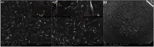 Figure 7 Visualization of the interaction of HS-5 cells with nanofilms using scanning electron microscopy.Notes: (A1) Control group (A2 and A3) C60-20%. Red stars and yellow arrows indicate lamellipodia and filopodia, respectively. The dotted line indicates edges of the dots. Scale bars: A1 and A2 =300 μm and 20 μm, A3 =2.0 mm.Abbreviation: C60, fullerenes.