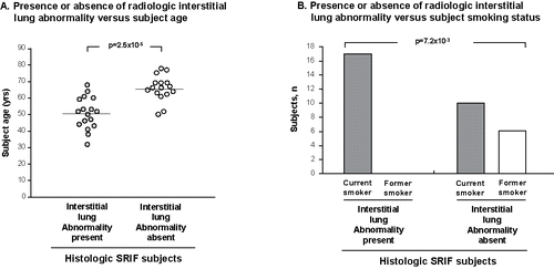 Figure 5. Analysis of pooled data of SRIF subjects (authors’ cohorts and other described cohorts in the published literature) with known status regarding radiologic interstitial lung abnormality (ILA), see text. A. Influence of subject age on radiologic ILA. Each dot represents an individual subject. Mean age represented by horizontal line. B. Histogram showing the effect of smoking status on radiologic ILA in the same SRIF subjects as in panel A.