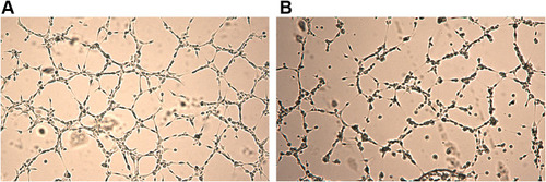 Figure 9 Capillary tube formation assay. This assay indicated functional decrease in HUVEC after exposure to ZnO NPs. The pictures show tube formation after treatment with ECGM ((A); negative control) and 15 µg/mL ZnO NPs (B). Tube formation was analyzed automatically by ImageJ with the Angiogenesis Analyzer plugin.