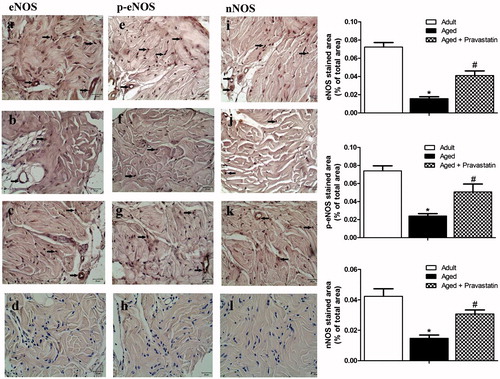 Figure 5. Representative photomicrographs for eNOS (a–d), p-eNOS (e–h) and nNOS (i–l) immunohistochemistry in adult (a, e and i), aged (b, f and j) and aged treated with pravastatin (c, g and k) corpus cavernosum tissues. Insets in d, h and l represent the negative control immunostainings of eNOS, p-eNOS and nNOS, respectively. Arrows indicate eNOS, p-eNOS and nNOS expressions in corpus cavernosum tissues. The graphs show image analysis results after immunohistochemistry. *p < 0.05 as compared with adult rats and #p < 0.05 as compared with aged rats.